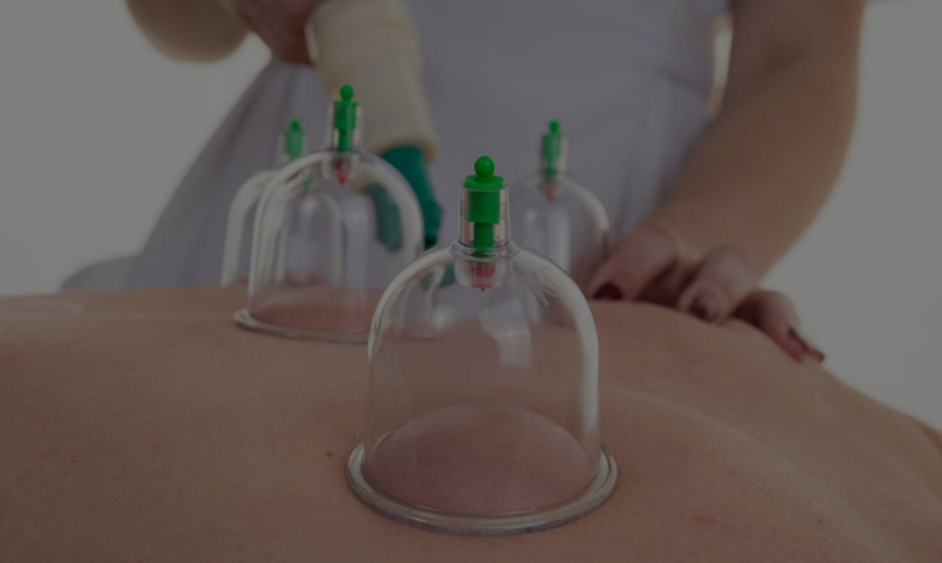 Cupping Therapy - Miracle Cure - Quick Recovery
